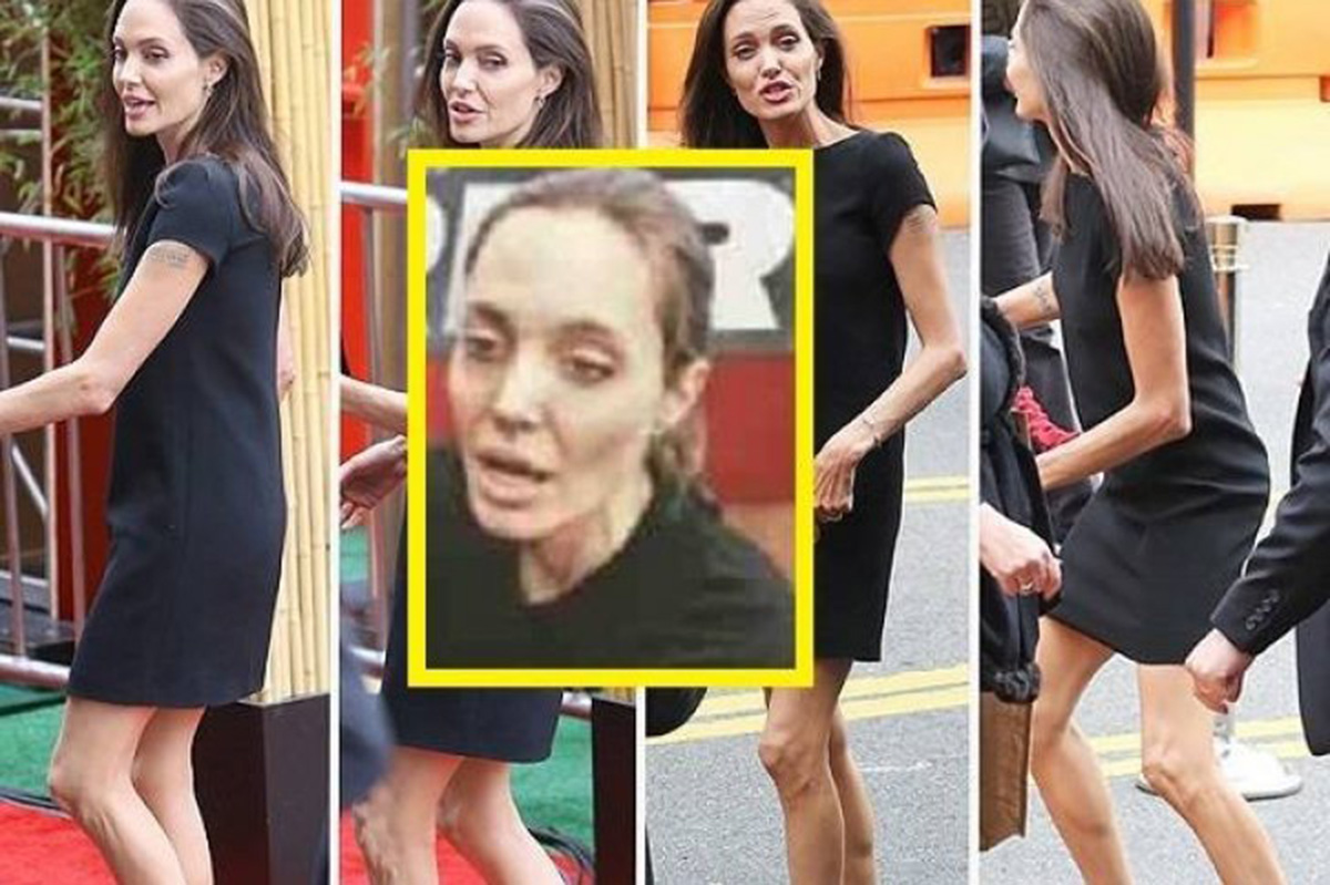 Hospitalizan a Angelina Jolie por su extrema delgadez
