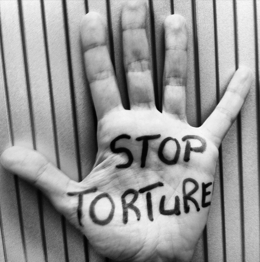 DERECHOS SIN REVÉS / Actos de tortura y tratos crueles