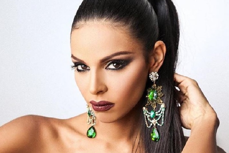Keysi Sayago, Miss Venezuela 2016, pasó varias veces por el quirófano
