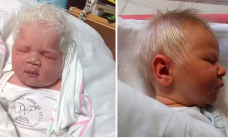 Bebé que causa furor por su peculiar color de cabello