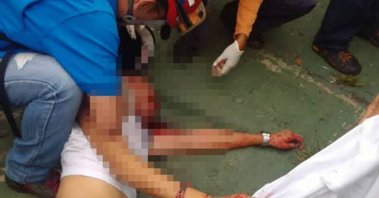 Murió hombre herido de bala en la cabeza en Mérida