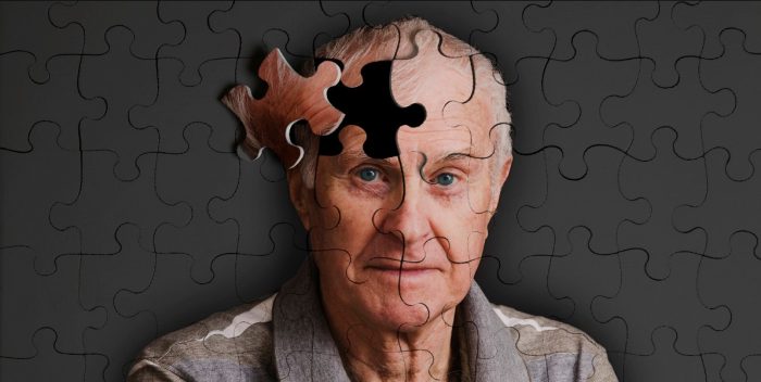 Científicos en Italia descubren origen del Alzheimer