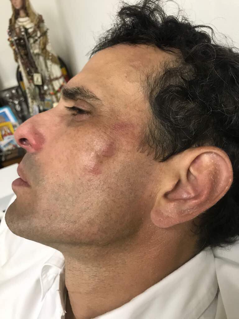 Gobernador Capriles y diputado Paparoni heridos durante protesta del lunes