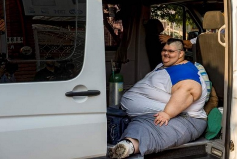Operado con éxito el hombre más obeso del mundo