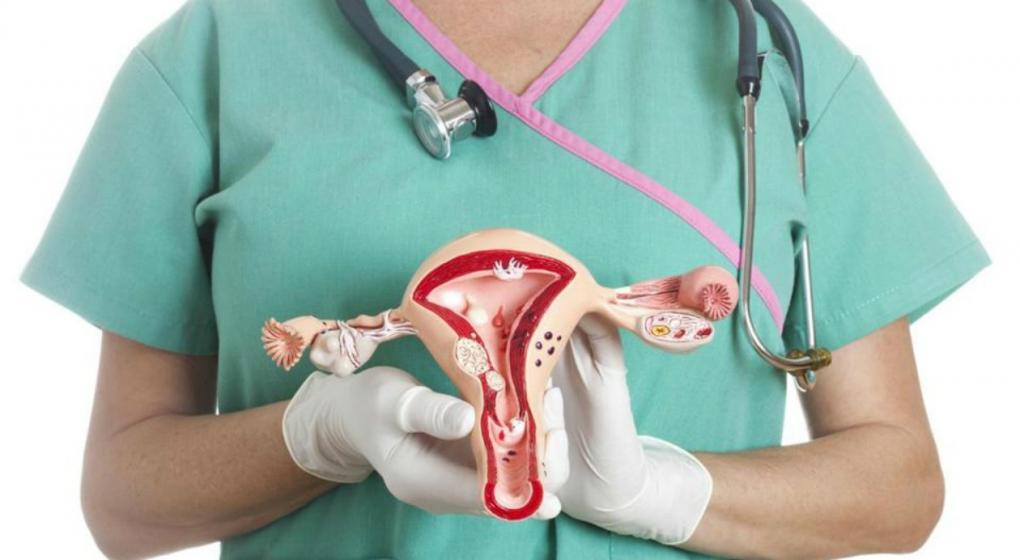 Cáncer de ovario mata al 70%  de las afectadas
