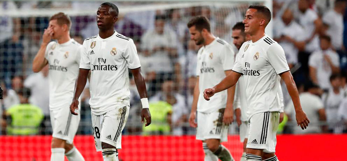 Real Madrid viajó con duras bajas