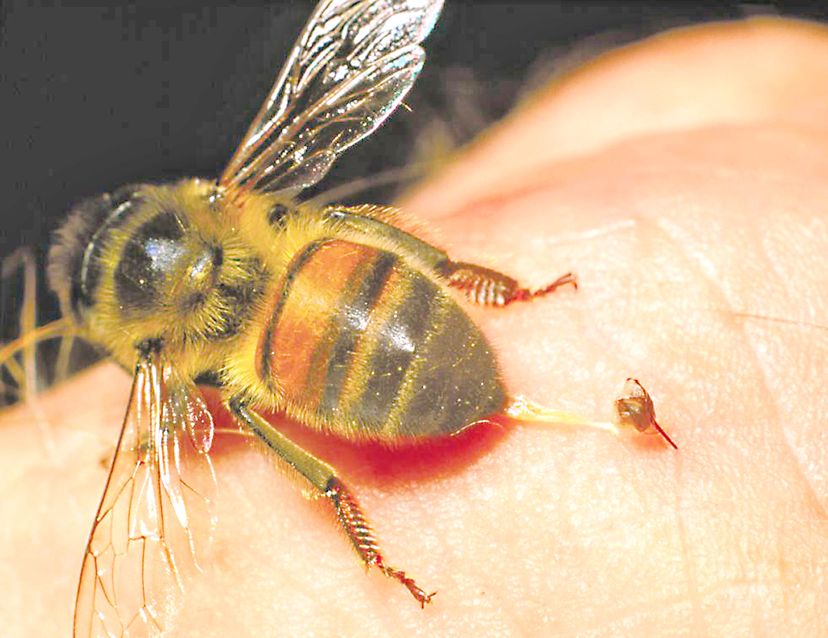 Picaduras de abeja