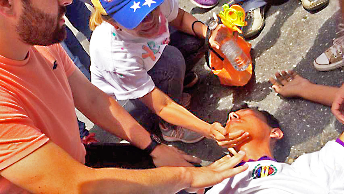 Herido manifestante  en Barquisimeto