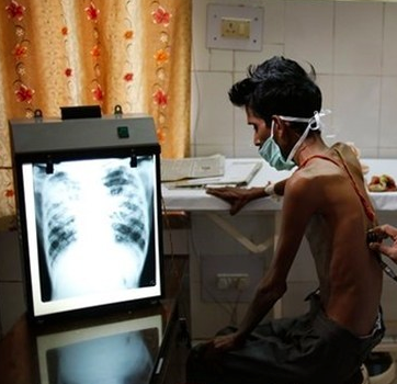 Especialistas se preocupan por condiciones de tuberculosos en Venezuela