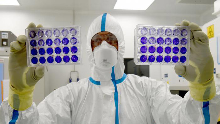 Cepa brasileña podría sortear anticuerpos de la Coronavac