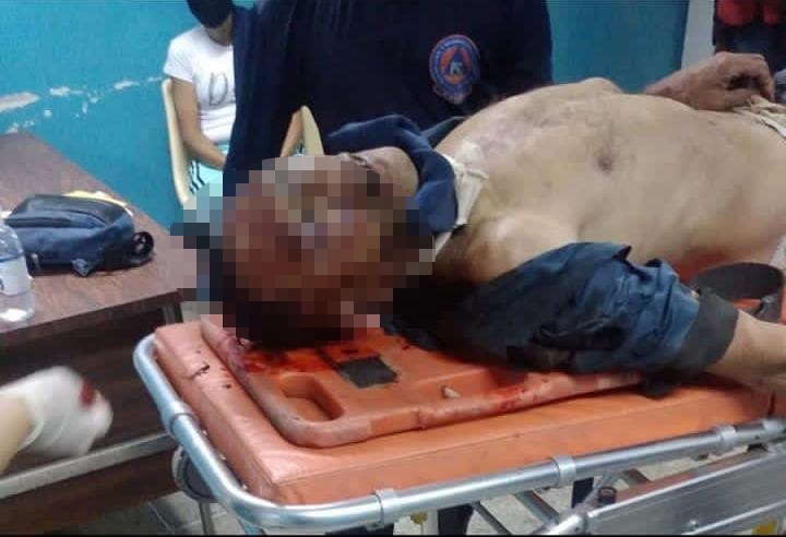 Localizan hombre casi muerto en Los Nuevos Teques