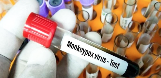 OMS insta a no realizar vacunaciones masivas contra viruela del mono