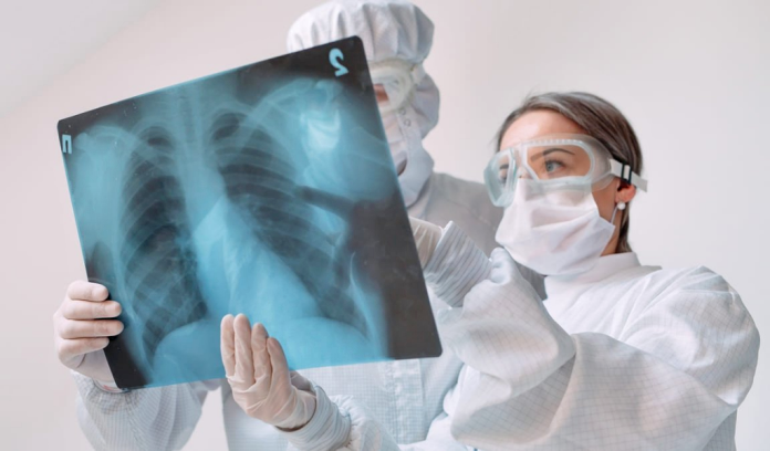“Casi 50 trabajadores sanitarios de Venezuela se infectaron de tuberculosis”