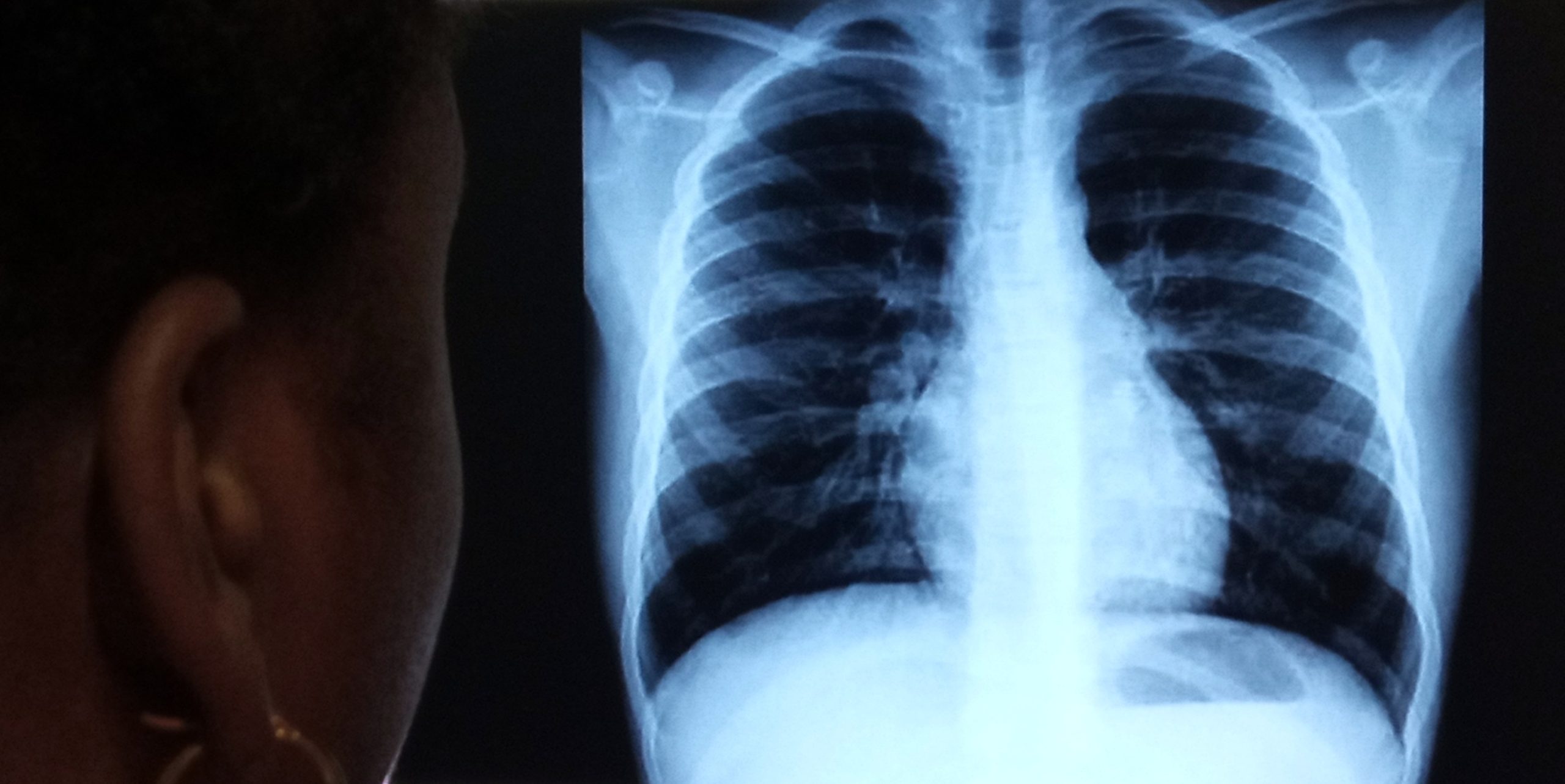 <strong>Una radiografía cuesta entre 10 y 70 dólares</strong>