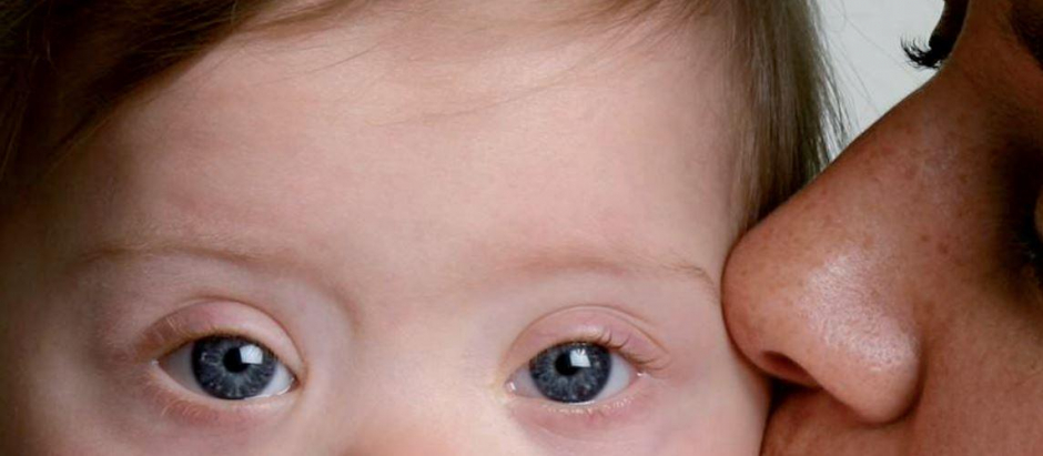 1 de 1.000 recién nacidos puede padecer síndrome de Down