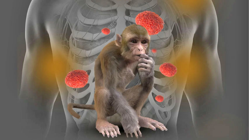 Médicos persisten en activar alarma sanitaria ante casos de viruela del mono