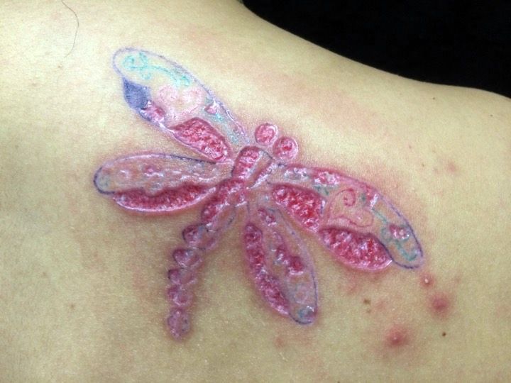 Mala cicatrización en tatuajes puede provocar infecciones en la piel