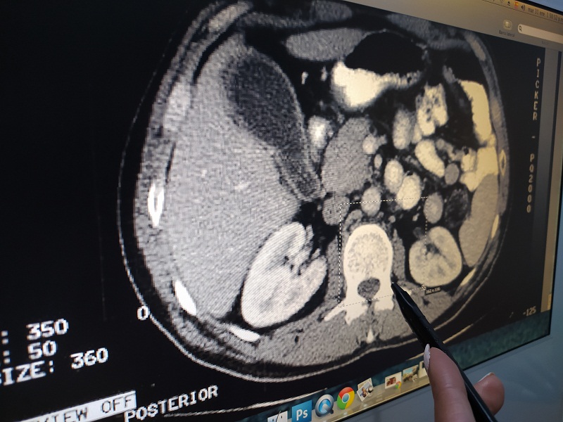 Una tomografía pélvica abdominal oscila entre los $300 a $630