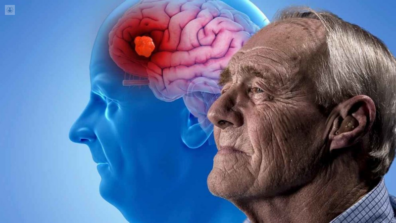 Recomiendan no apartar a pacientes con Alzheimer