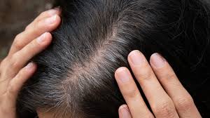 Advierte sobre aparición de canas producto del estrés