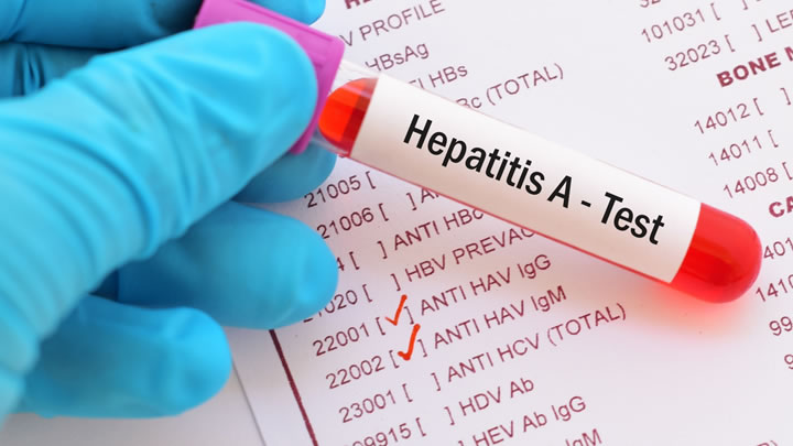 “La higiene es la mejor protección contra el virus de la Hepatitis A”