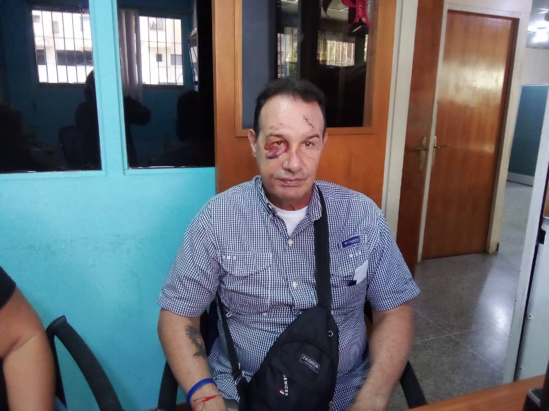 “Me hicieron dos pruebas de alcoholímetro y dieron negativas”