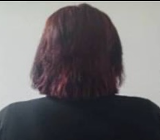 Aumentaba labios y glúteos sin tener título universitario