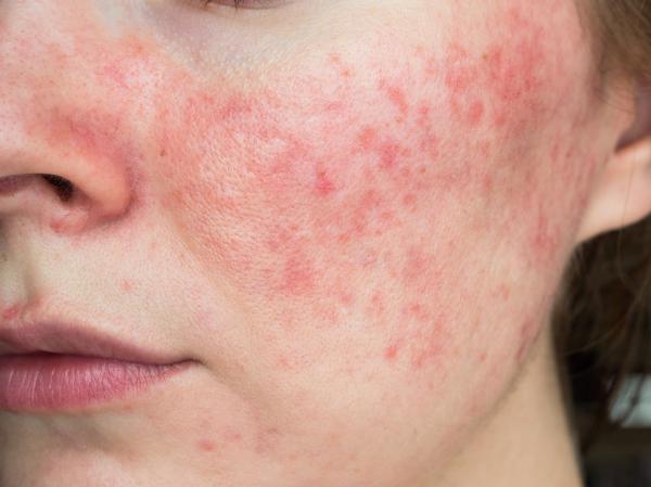 Alertan sobre daños en la piel por uso excesivo de maquillaje