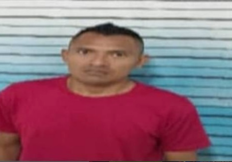 Le arrancó un pedazo de nariz a su ex