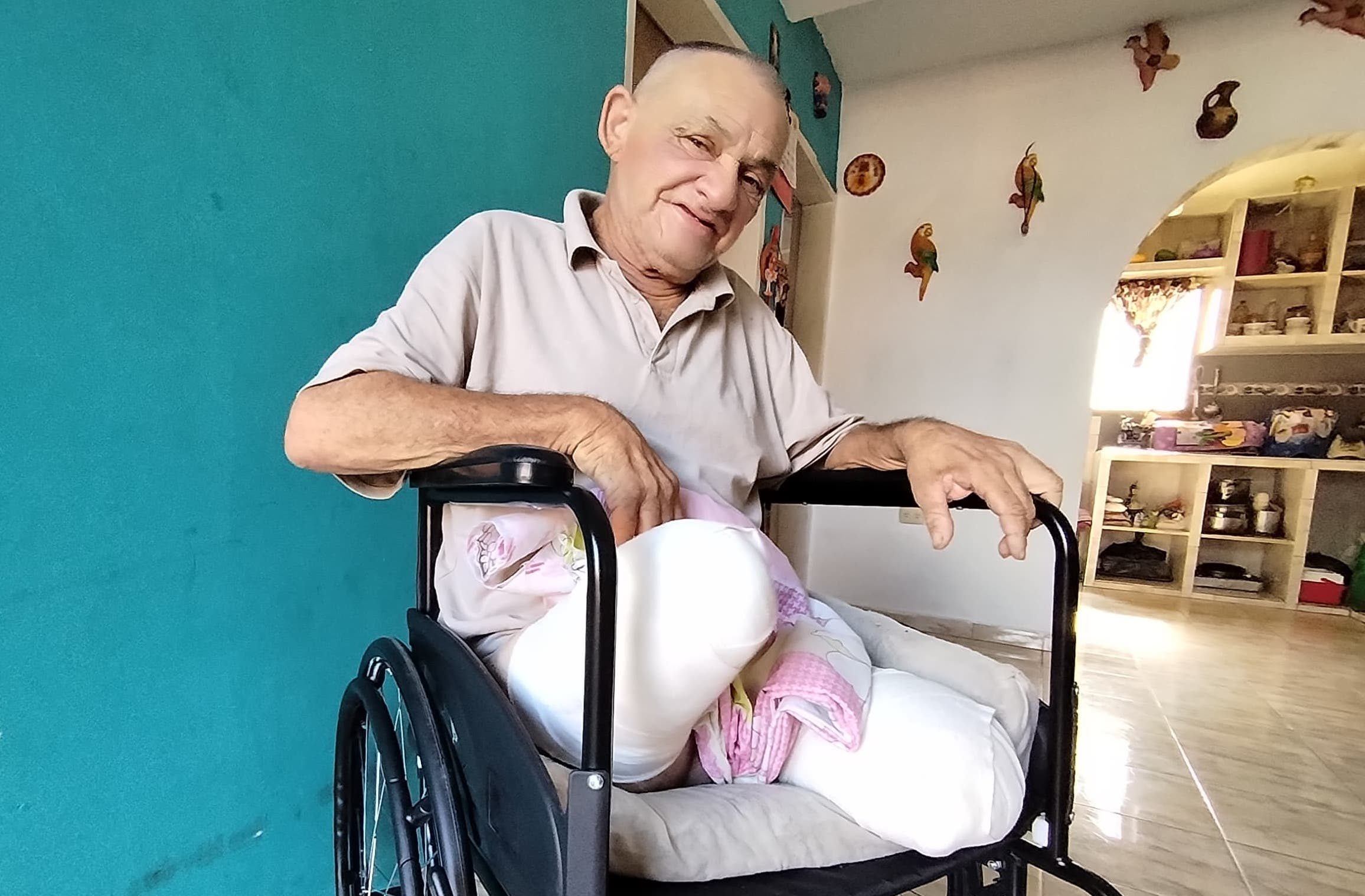 A Orlando le amputaron la pierna equivocada