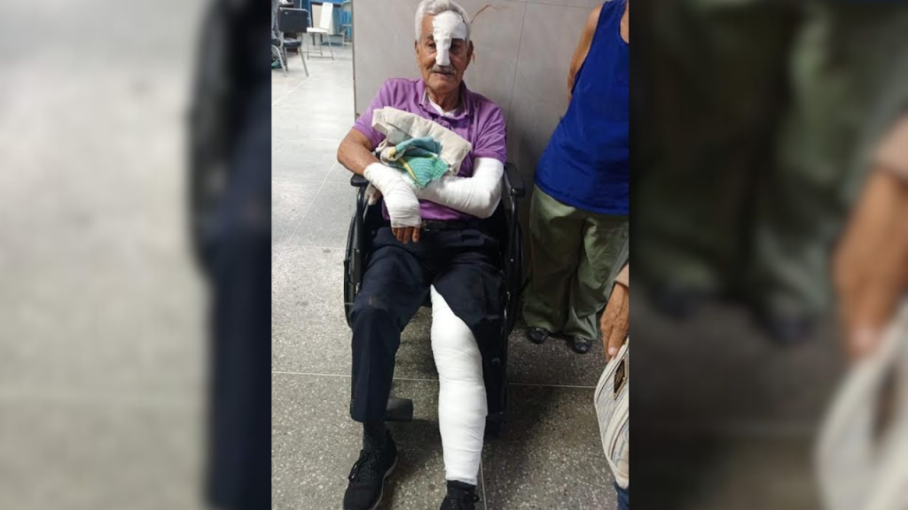 Adulto mayor sufrió fractura tras caer en un puente