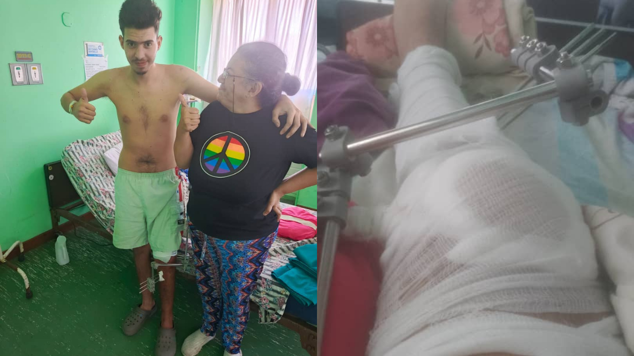 Una imprudencia ajena le cambió la vida a Ronny