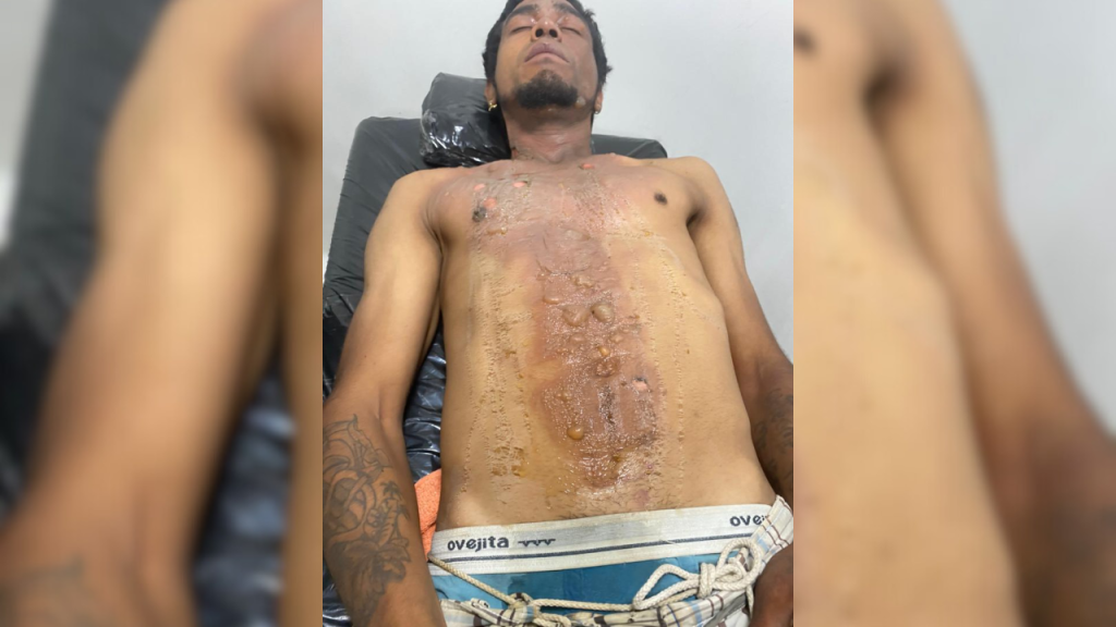Mujer le lanzó agua caliente a hombre