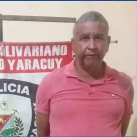Imputado por femicidio hombre que quemó a su pareja