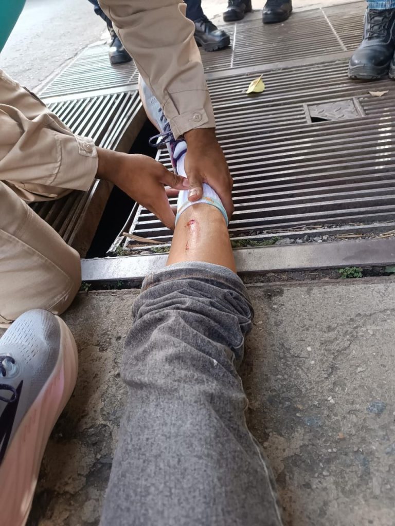 Alcantarilla rota causa accidentes en la Roscio