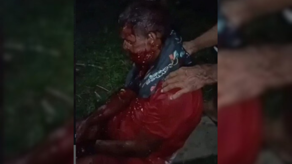 Puma atacó a un hombre en Carabobo