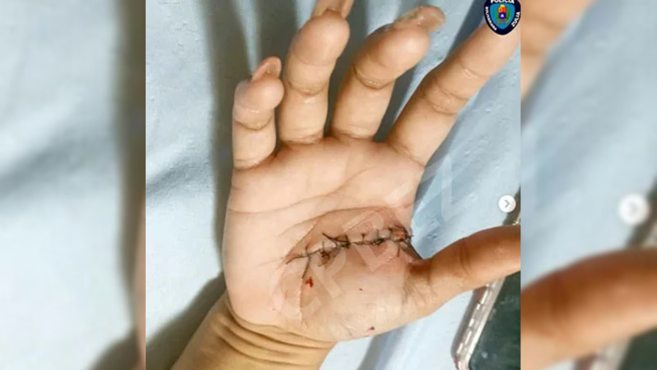 Hombre hirió a una mujer y mató a su perrito