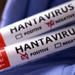 hantavirus