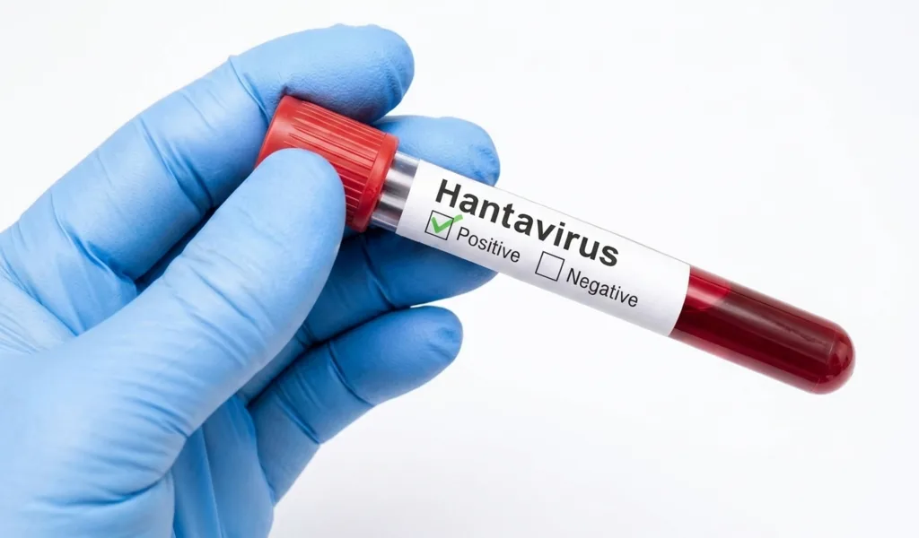 HANTAVIRUS-EN-VENEZUELA