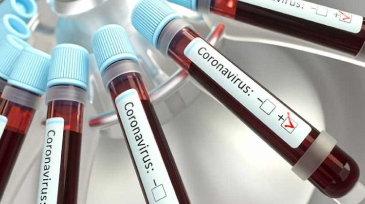 1 Coronavirus