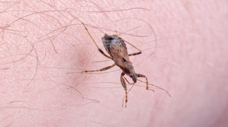1 Mal-de-Chagas