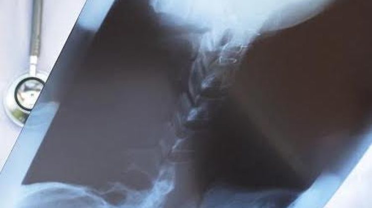 Doctor examine x-ray film over white background
