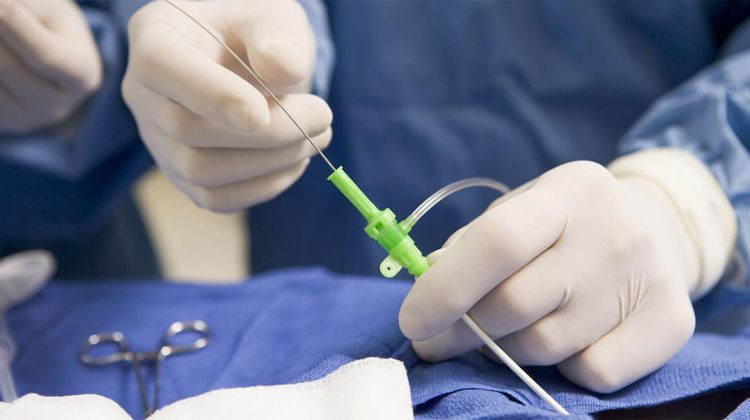 cateterismo-cardiaco-2