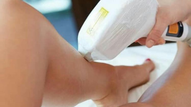 depilacion de piernas
