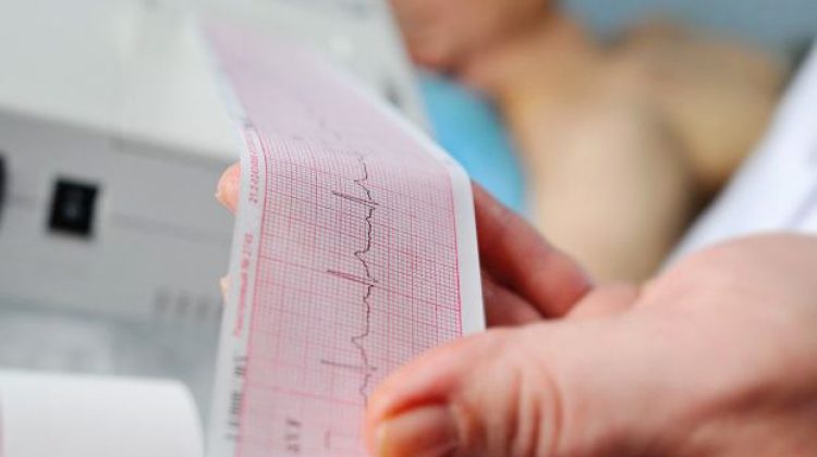 electrocardiograma