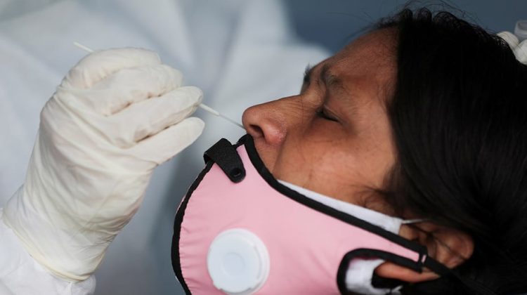 la-covid-19-reta-la-efectividad-de-las-pcr-y-las-pruebas-de-anticuerpos