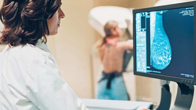 mammogram-645
